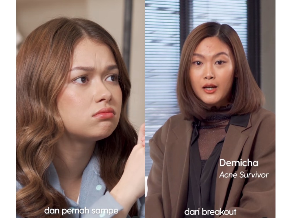 nama-beauty-campaign-kawanlawanjerawat