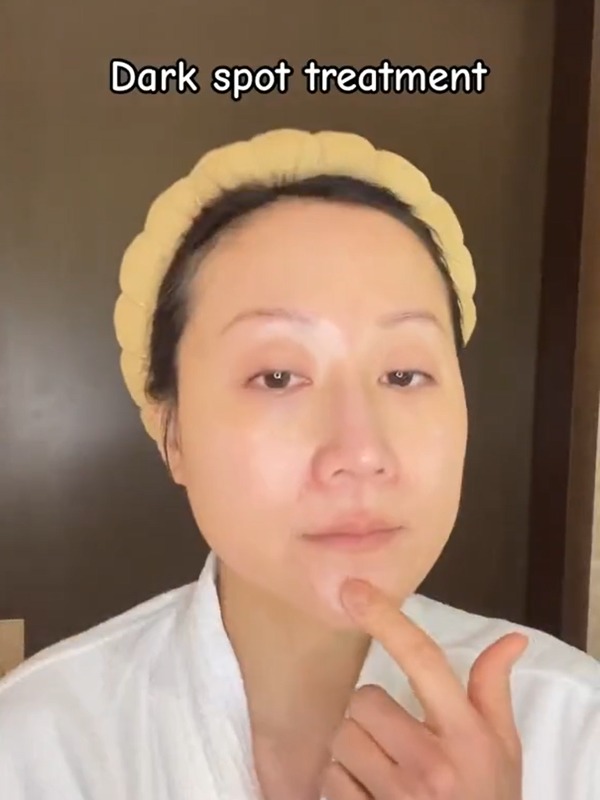 rutinitas-skincare-untuk-mengatasi-bekas-jerawat-and-hiperpigmentasi