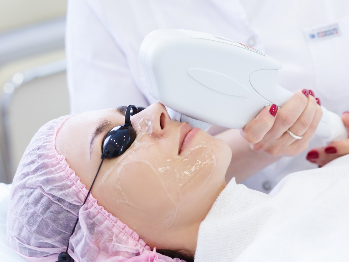 Review: Mencoba IPL Acne Treatment dan Oxy Facial di A-ONE Beauty Clinic untuk Bantu Kurangi Jerawat - Beauty Journal