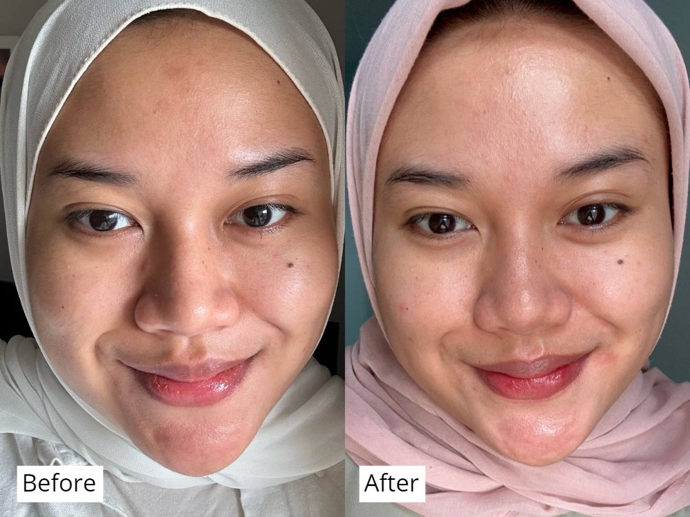 Viva Queen Pro-Age Advance Series