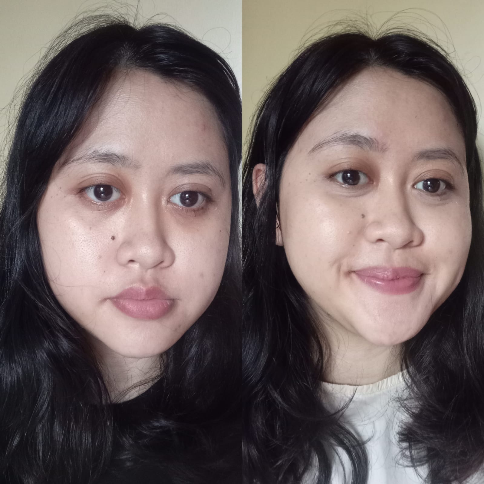 review-avoskin-new-your-skin-bae-serum