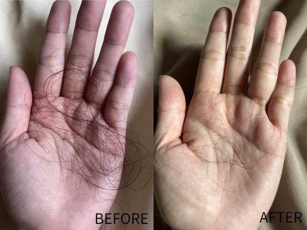 Review Varesse Serum Shampoo & Hair Tonic Concentrate, Benarkah Ampuh Kurangi Rambut Rontok