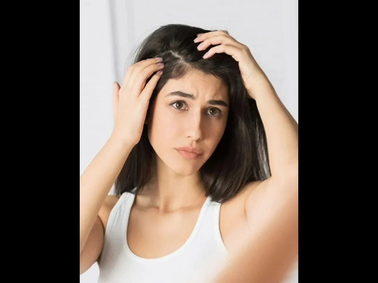 Kenali 8 Penyebab Kulit Kepala Sensitif yang Mungkin Belum Kamu Tahu