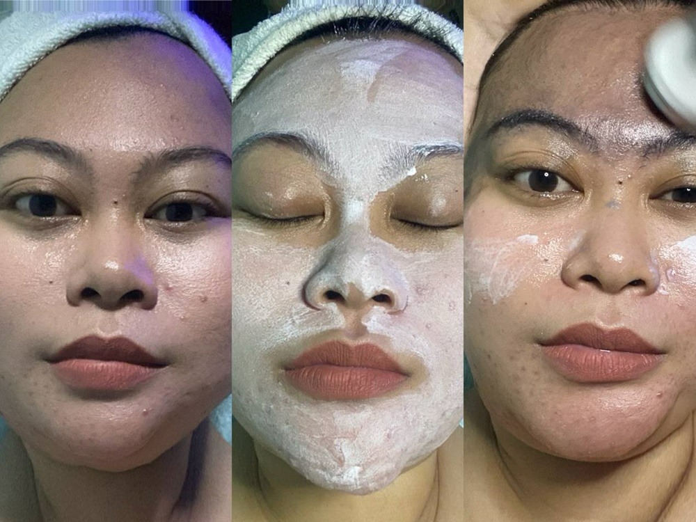 review-treatment-klinik-kecantikan-di-yogyakarta-superglow-clinic
