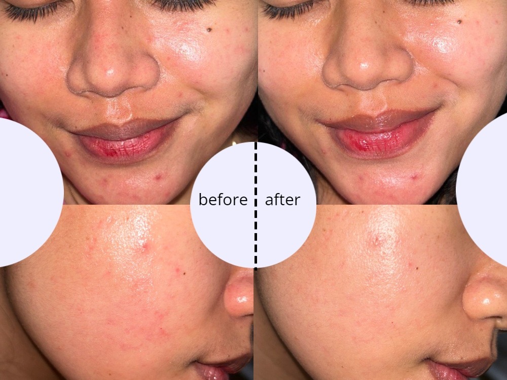 Review Somethinc Calm Down! Skinpair R-Cover Cream