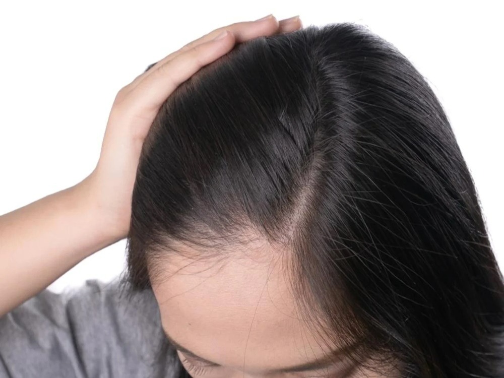 cara-mengatasi-kulit-kepala-kering