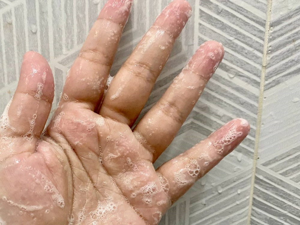 review-grace-and-glow-acne-body-wash-white-truffle