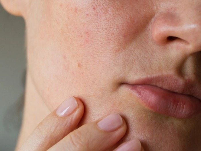 7-penyebab-kulit-kusam-dan-cara-mengatasinya