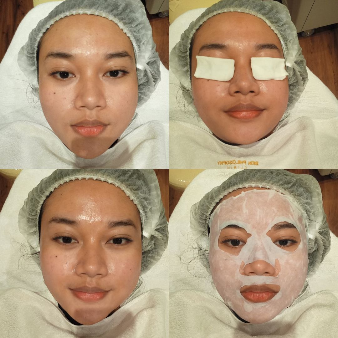 Pengalaman Treatment di Skin Philosophy Clinic