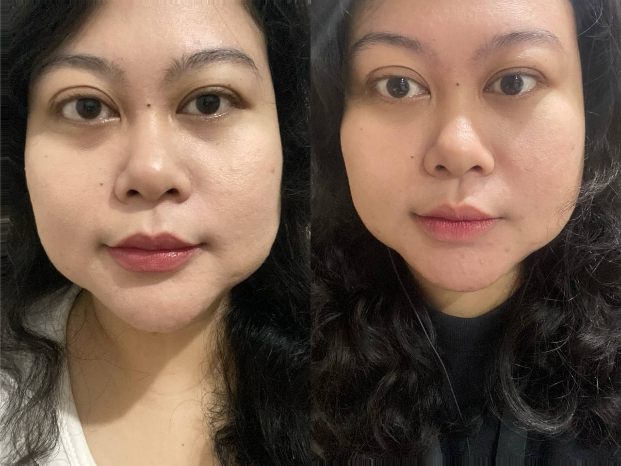 review-the-originote-eye-serum