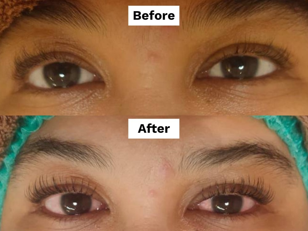 review-everlash-healthy-long-lash