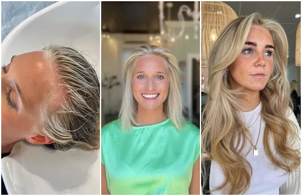 Scandinavian Hairline