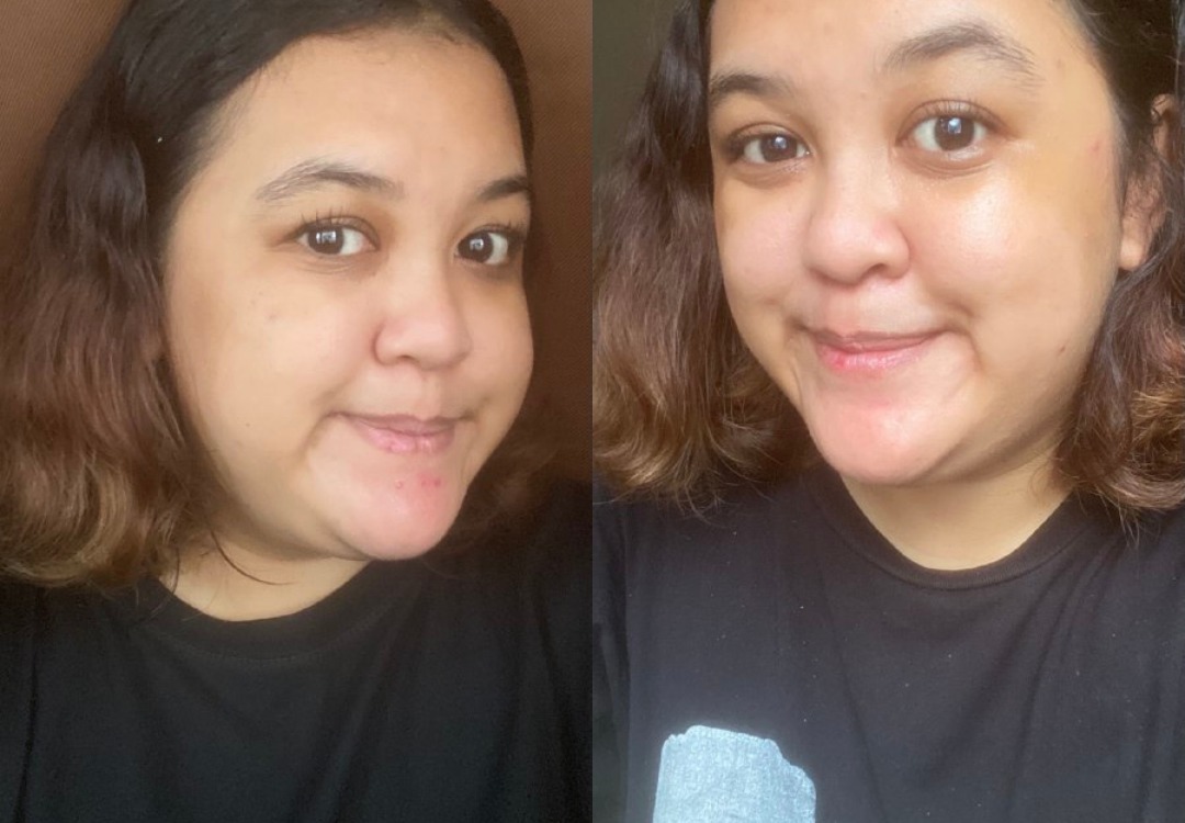 review-avoskin-new-your-skin-bae-serum