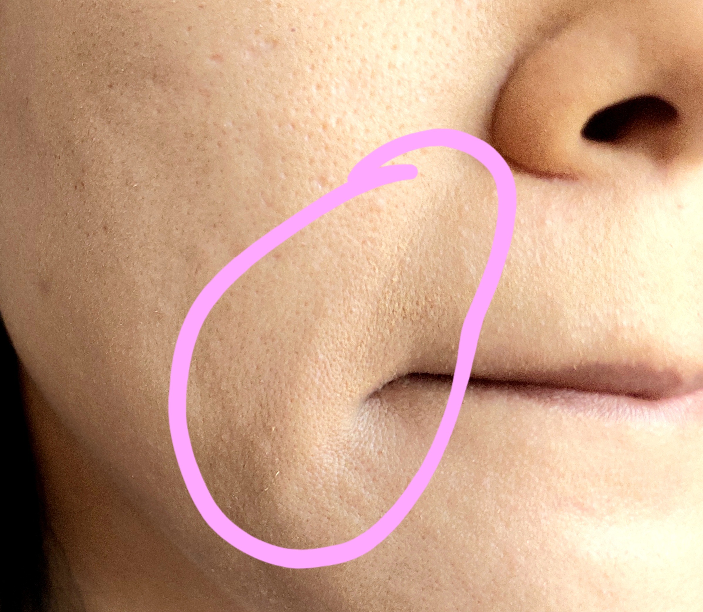 Kesulitan meratakan foundation.